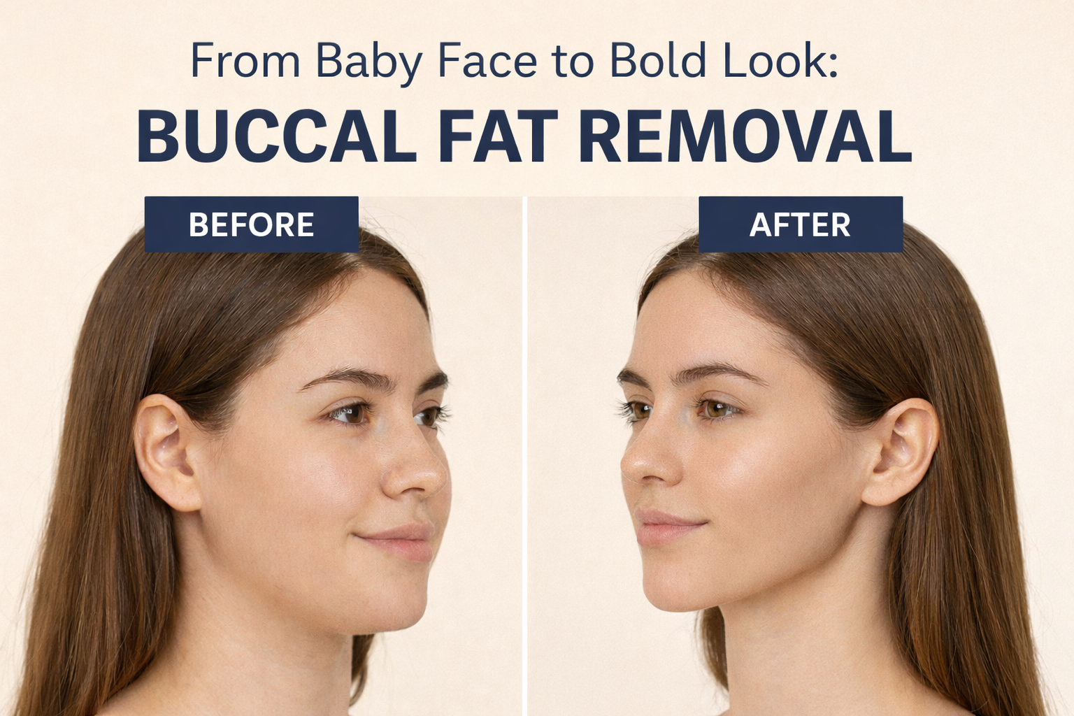 From Baby Face to Bold Look Buccal